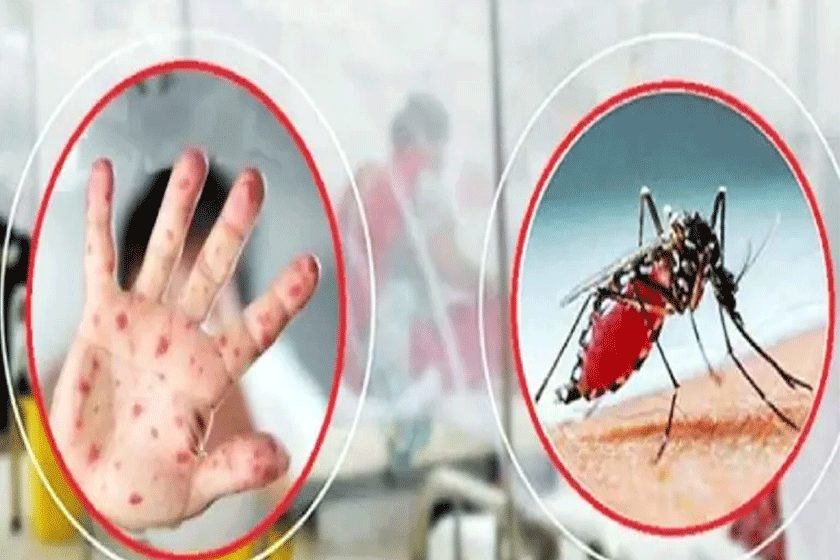 হামের উপসর্গে আট মৃত্যু, ডেঙ্গুতে ছয় জনের